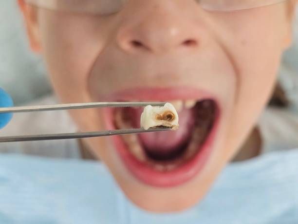 Best Emergency Treatment for Jaw Pain or Injury in Roaring Spring, PA